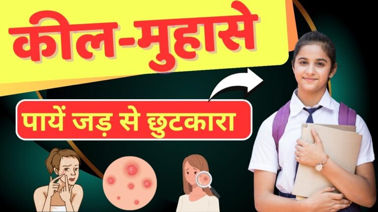 chehre par kil muhaso ka ilaaj