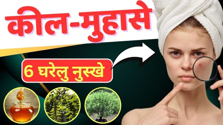 सर्दियों में कील-मुंहासे दूर करने लिए : 6 बेहतरीन घरेलू नुस्खे और प्राकृतिक तरीके से पाएं चमकती त्वचा
