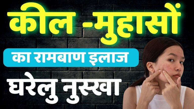 कील-मुंहासों का रामबाण इलाज
