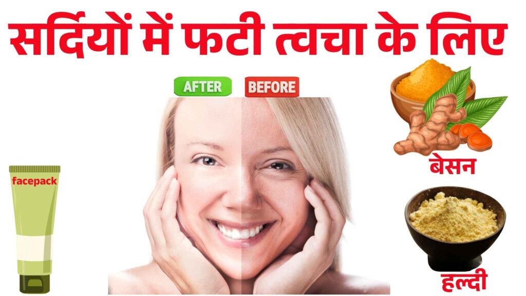 सर्दियों में फटी त्वचा के लिए बेसन और दही का फेस पैक