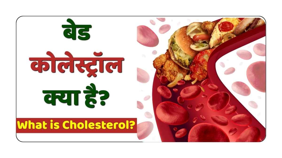 बेड कोलेस्ट्रॉल क्या है?